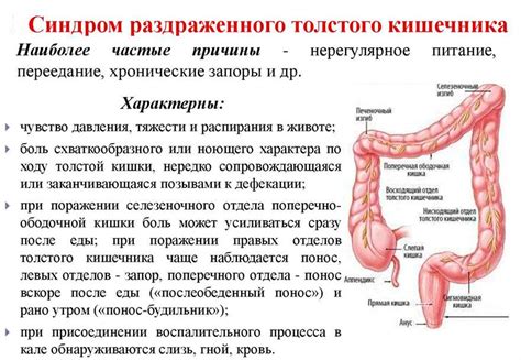 Осложнения неоплазии сигмовидной кишки