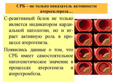 Осложнения нестенозирующих атеросклеротических изменений маг