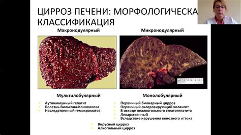 Осложнения отбитой печени