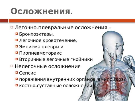 Осложнения отрыва легкого