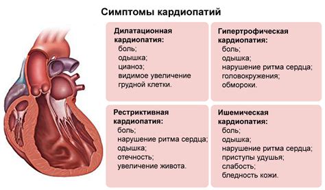 Осложнения от медленного сердцебия