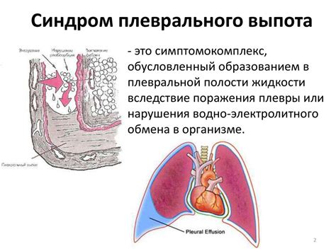 Осложнения плеврального поражения неуточненного