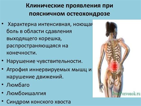 Осложнения при поясничном остеохондрозе 2 степени