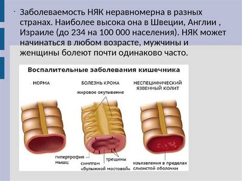 Осложнения увеличен кишечника