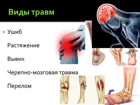 Основные виды травм, вызывающих боли в ноге