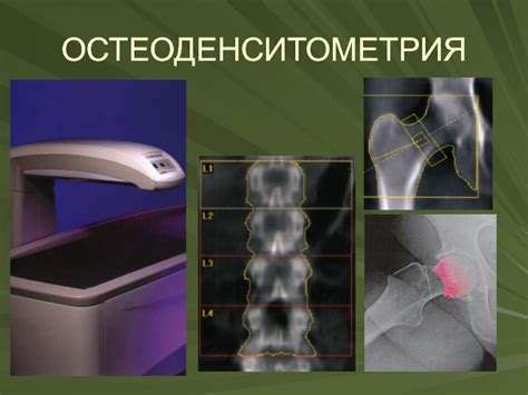 Основные методы измерения минеральной плотности костей