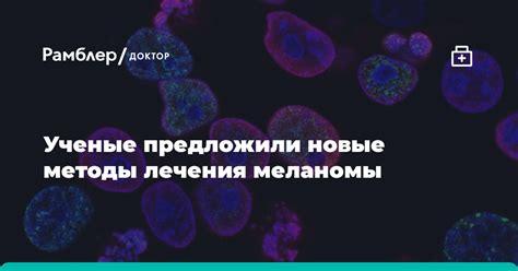 Основные методы лечения злокачественной меланомы