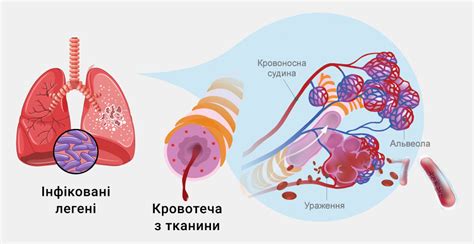 Основные последствия легких Общемозговых нарушений