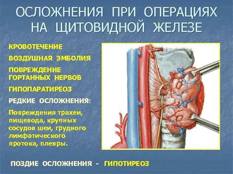 Основные преимущества исследования кровотока в щитовидной железе