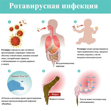 Основные признаки инфекции