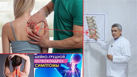 Основные признаки поражения шейного отдела позвоночника