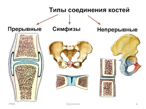 Основные принципы непрерывного соединения костей