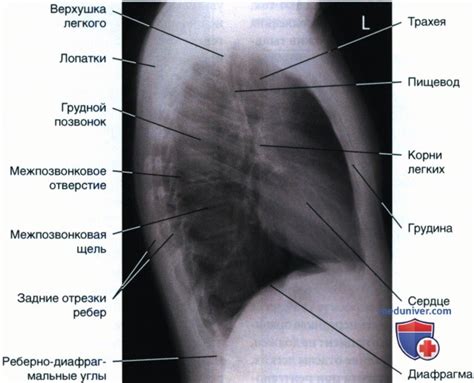 Основные принципы работы Рентген ОГК