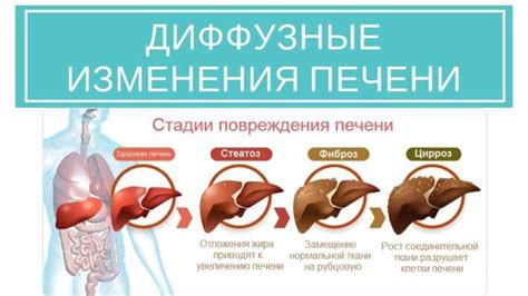 Основные причины незначительных диффузных изменений печени