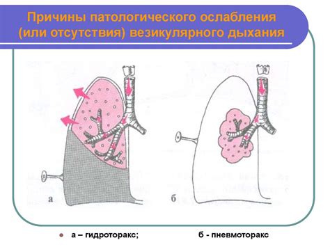 Основные причины отсутствия дыхания