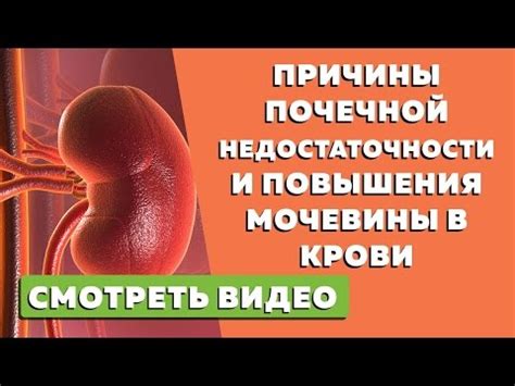 Основные причины повышенного уровня мочевины