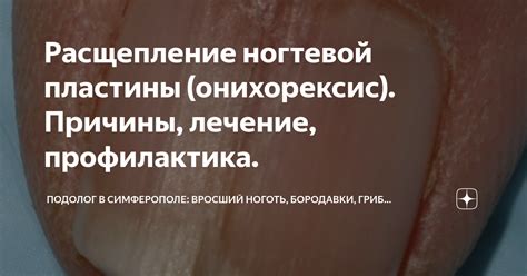 Основные причины появления ребристости ногтевой пластины