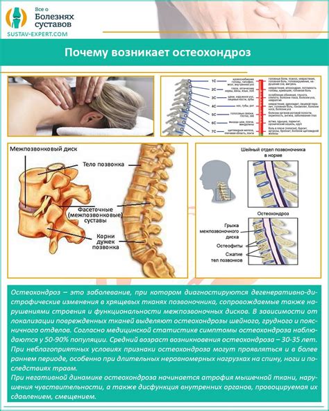 Основные причины развития грудной дорсопатии