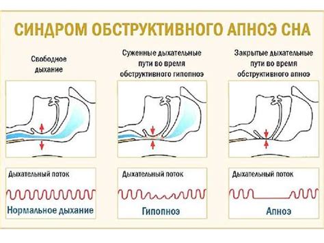 Основные причины этого заболевания