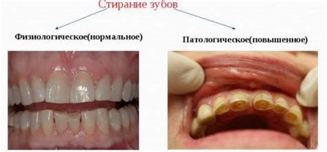 Основные проблемы зубов и их лечение