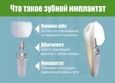 Основные противопоказания и риски операции по быстрой имплантации