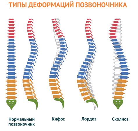 Основные симптомы деформации