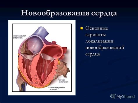 Основные симптомы кровоточащих новообразований