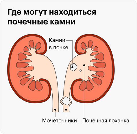 Основные симптомы неопластического процесса в почке