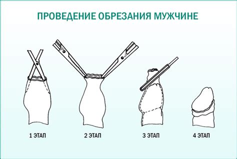 Основные симптомы обрезания у мужчин