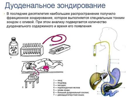 Основные симптомы описторхоза