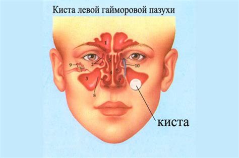 Основные симптомы отека пазухи