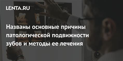 Основные симптомы патологической подвижности