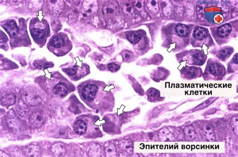 Основные симптомы повышенного количества плазматических клеток