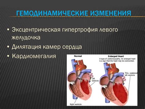 Основные симптомы расширения диафрагмы сердца