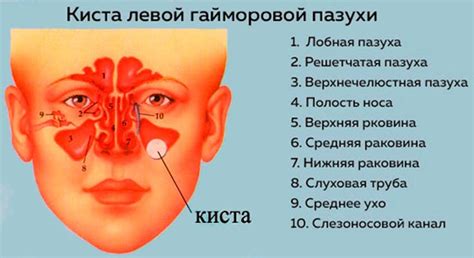 Основные симптомы сниженной пневматизации гайморовой пазухи