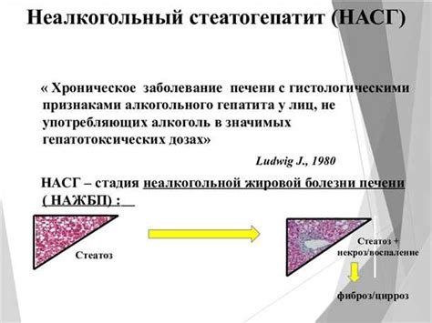 Основные симптомы стеатогепатита умеренной степени активности