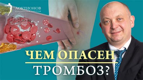 Основные симптомы тромбоза