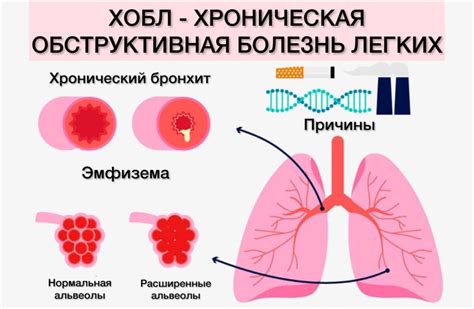 Основные симптомы эмфизематозных изменений легких