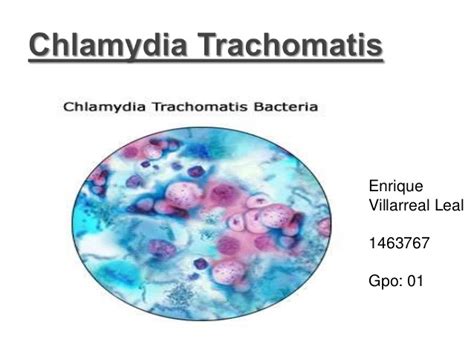 Основные симптомы chlamydia trachomatis