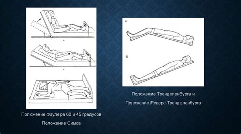 Основные характеристики марьяжной постели