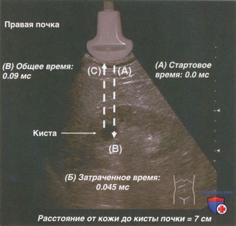 Основы и принципы ультразвукового исследования кровотока