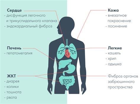 Основы редукции опухоли: что это такое?