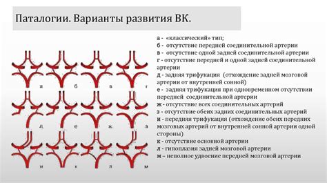 Особенности Виллизиева круга