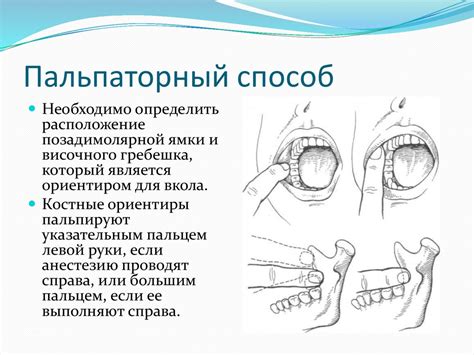 Особенности мандибулярной анестезии