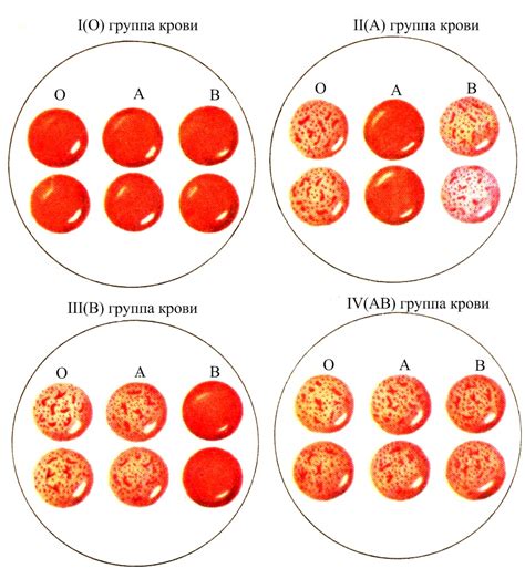 Особенности четвертой положительной группы крови