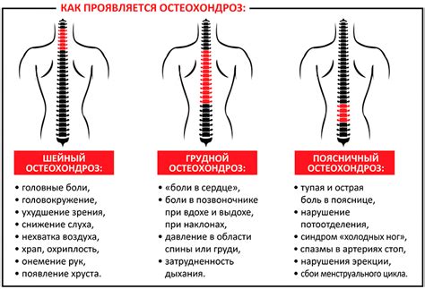 Остеохондроз: блокада и ее значение