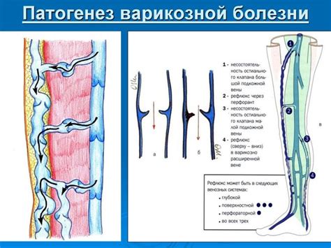 Остиальный клапан: что это значит?