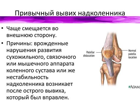 Острые или травматические повреждения нижней конечности