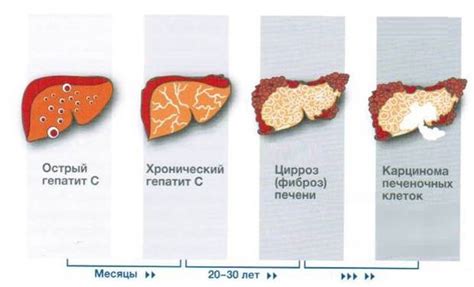 Острый и хронический гепатит