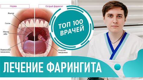 Острый и хронический эффект оскопления себя